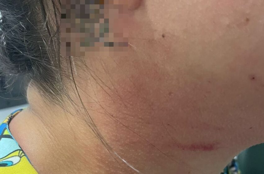  Mãe de paciente agride enfermeira em hospital infantil em Fortaleza