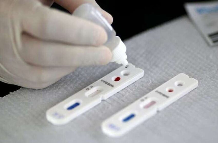 Com baixo estoque, laboratórios sugerem testes só para casos graves