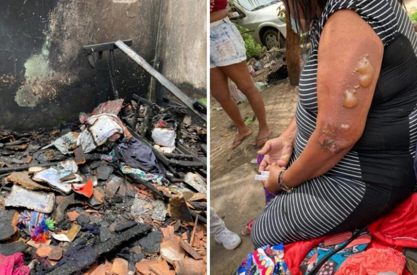  Incêndio faz desabar teto de casa e deixa feridos na capital cearense