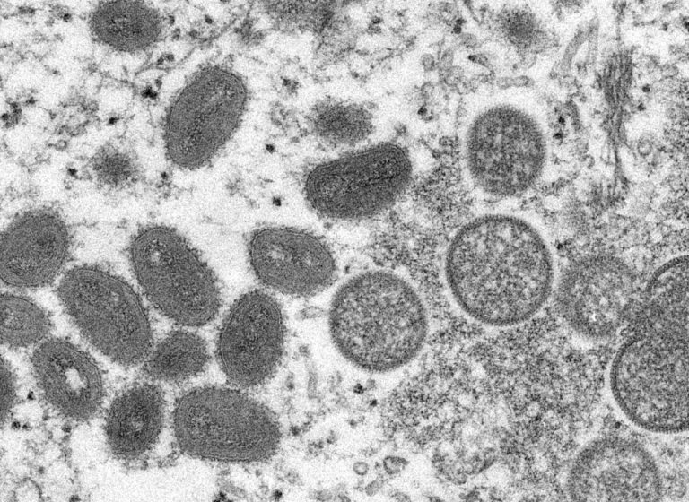  Sesa confirma primeiro caso de varíola dos macacos no Ceará