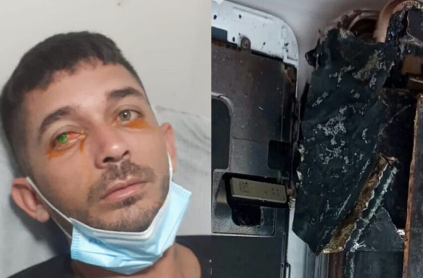 Jovem pode ficar cego de um olho após iPhone explodir na zona rural de Pedra Branca