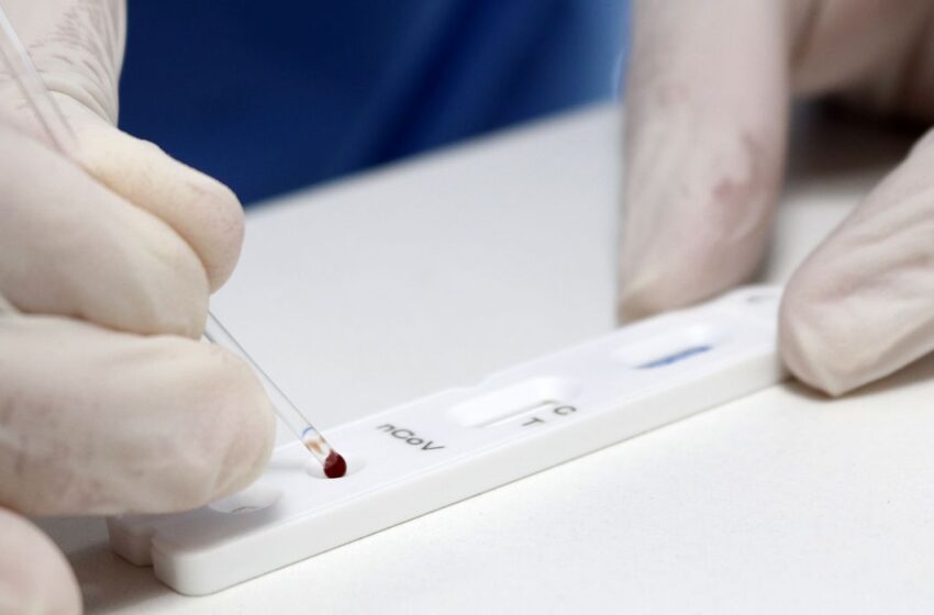  Brasil registra 155 mortes por Covid e mais de 46 mil casos