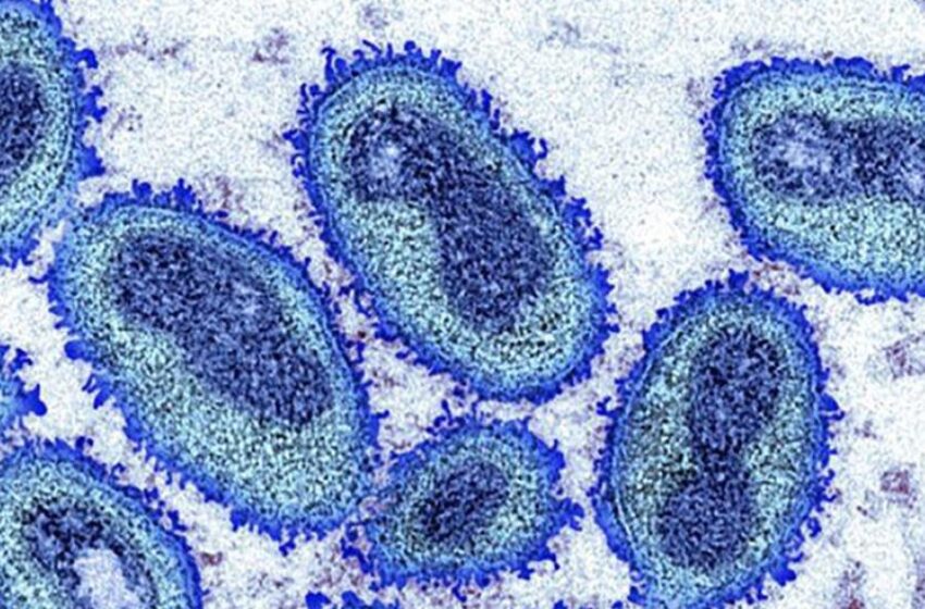  Sesa contabiliza 14 casos de monkeypox no Ceará