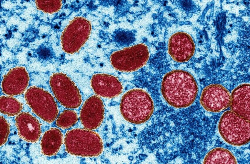  Ceará confirma sexto caso de varíola dos macacos