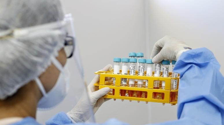  Testes Covid: após fechamento de centros, saiba onde fazer exames grátis no CE.