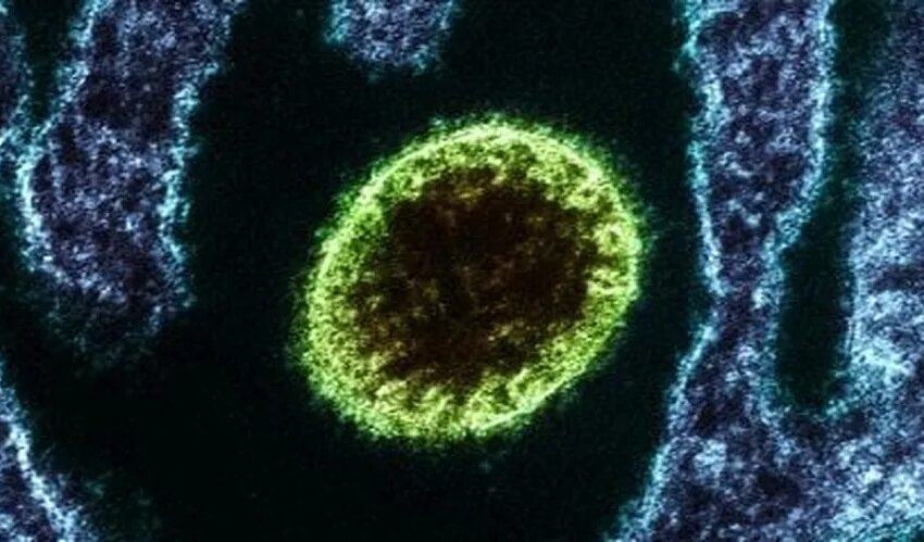  Nipah: sem cura, vírus que causa inchaço no cérebro mata menino na Índia e liga alerta.